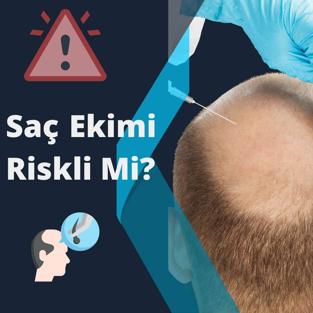 Saç Ekimi Riskli Mi?