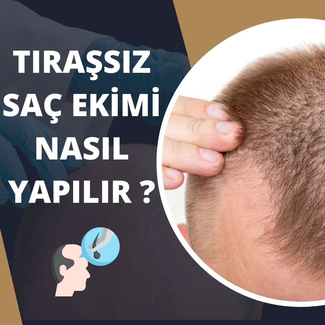 Tıraşsız Saç Ekimi Nasıl Yapılır