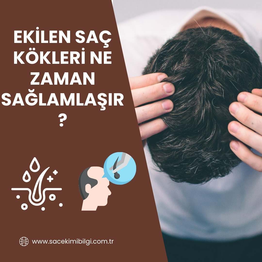 Ekilen Saç Kökleri Ne Zaman Sağlamlaşır ?