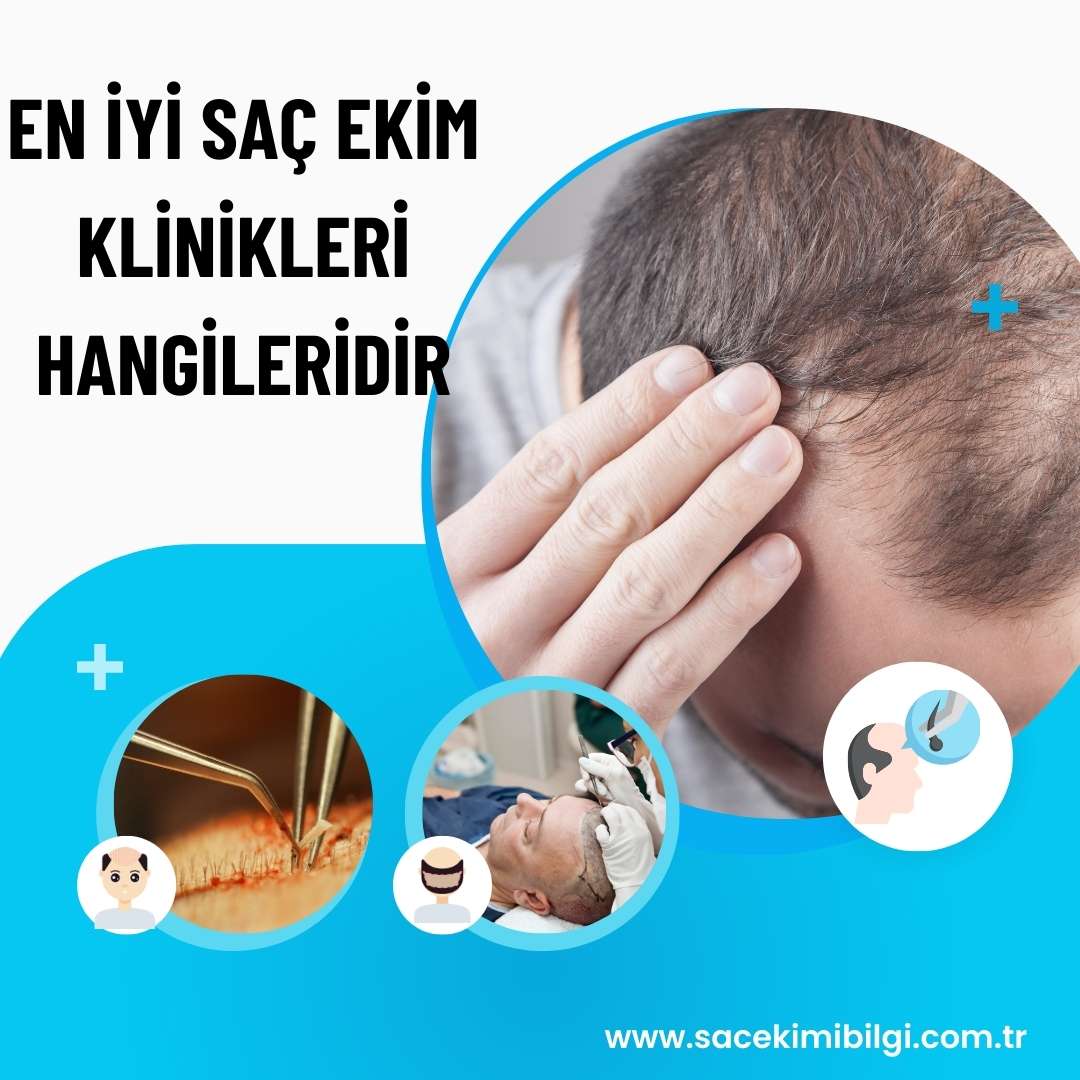 Saç Ekimi İçin En İyi Klinikler