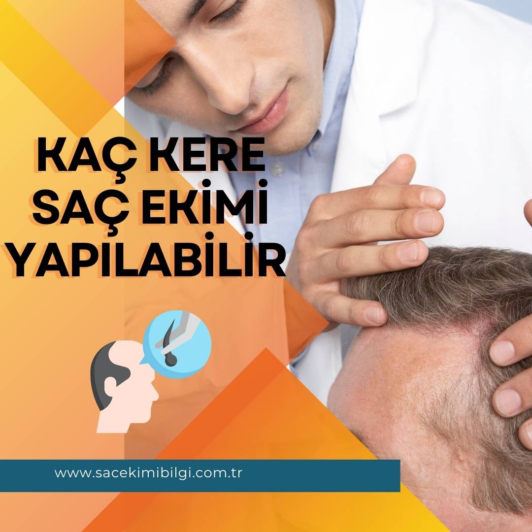 Kaç Kere Saç Ekimi Yapılabilir?