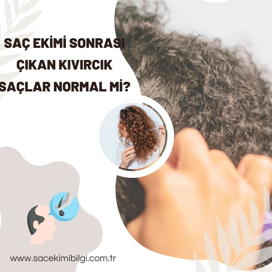 Saç Ekimi Sonrası Kıvırcık Çıkan Saçlar Normal Mi?