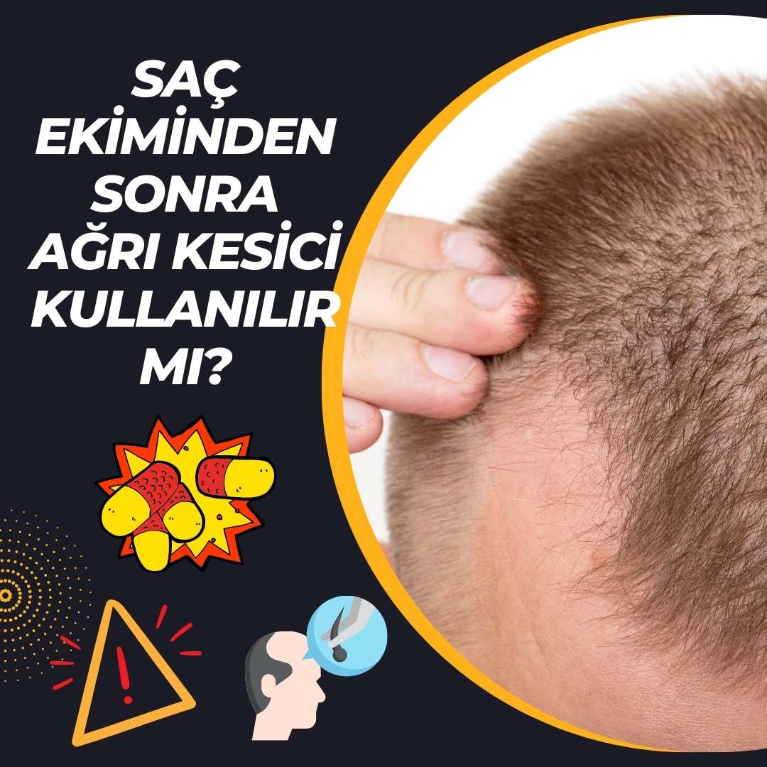 Saç Ekiminden Sonra Ağrı Kesici Kullanılır mı?