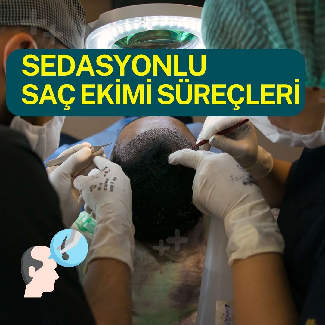 Sedasyonlu Saç Ekimi Nedir ?