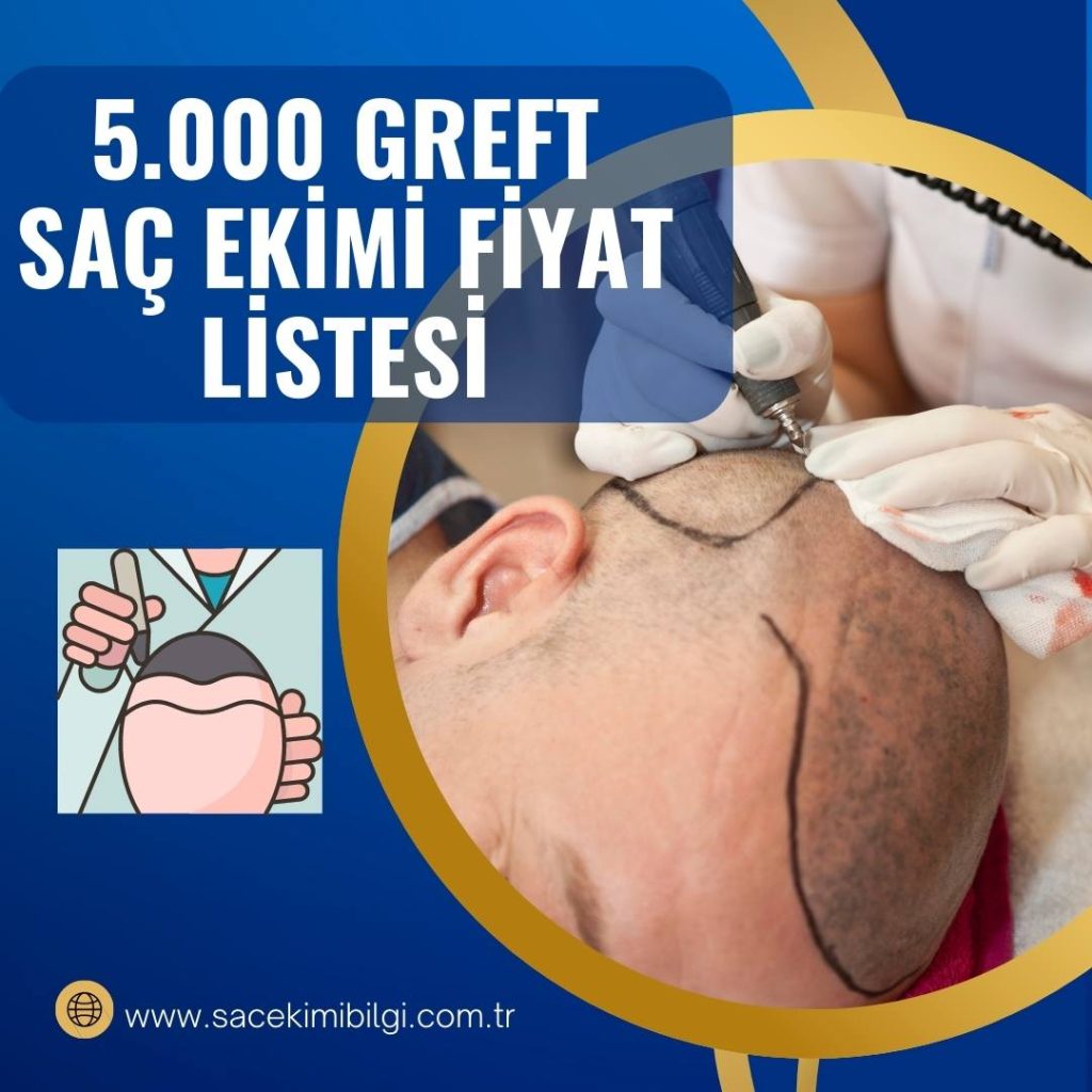 sa-ektirme-fiyatlar-sa-ekimi-bilgi