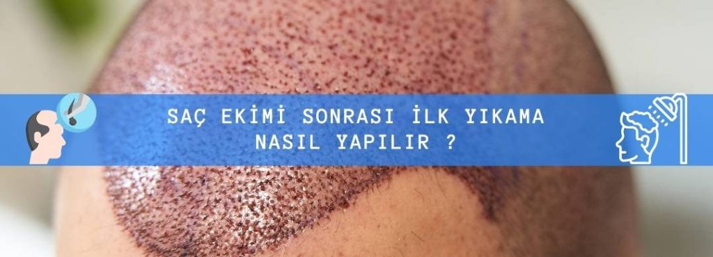 Saç Ekimi Sonrası İlk Yıkama Nasıl Yapılır?