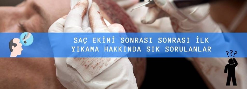 Saç Ekimi Sonrası İlk Yıkama Hakkında Sık Sorulan Sorular